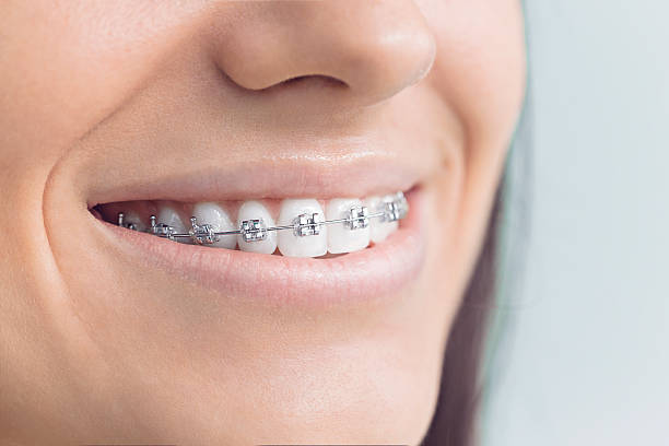 Best Traditional Braces  in Sunnyside, CA